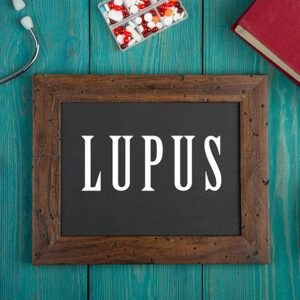 5 triggering factors of lupus to avoid