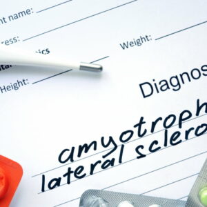 5 early warning signs of amyotrophic lateral sclerosis