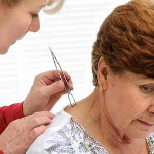 5 key signs of vasculitis